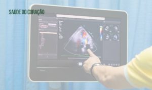 Ecocardiograma Transtorácico com Strain